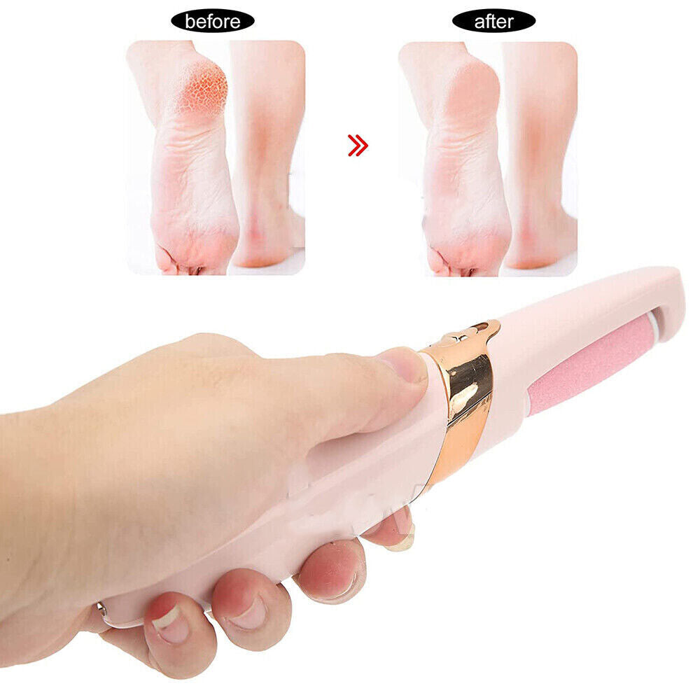 Portable Callus Remover